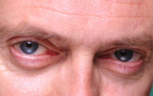 El bajón definitivo: los ojos de Steve Buscemi