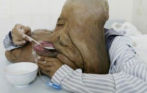 El hombre elefante chino