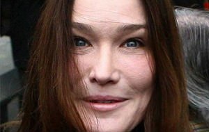 Los excesos de Carla Bruni con el Botox