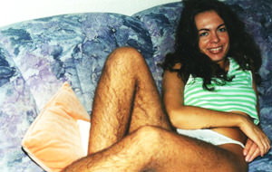 Cuando Hirsute Sandra casi dejó de ser hirsuta