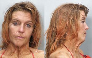 Las junkies también son personas