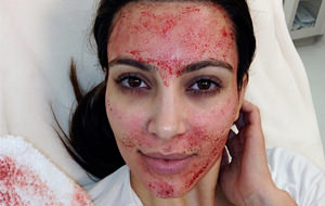 Kim Kardashian inventa el facial de sangre