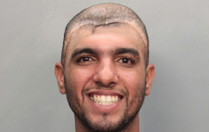 El impactante mugshot de un descerebrado