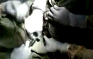 Cachondeo en el quirófano durante la extracción de un bote de espray del recto