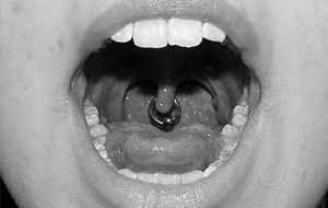 Piercing en la campanilla