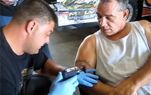 Eliminación de tatuajes para tipos duros