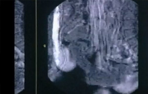 El sexo visto a través de un escáner MRI