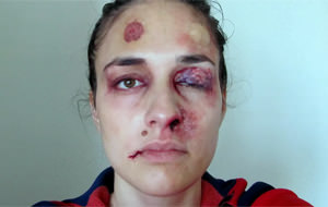 Un año entero de violencia machista